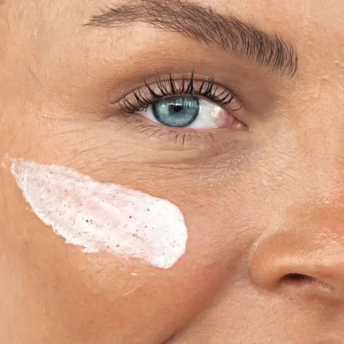 Close-up of a person's eye with a white patch on the skin
