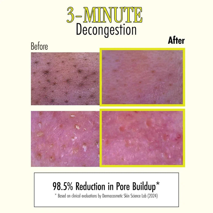 [BRMUD] Relief Mud Stick Mask 28g - Ballagrio