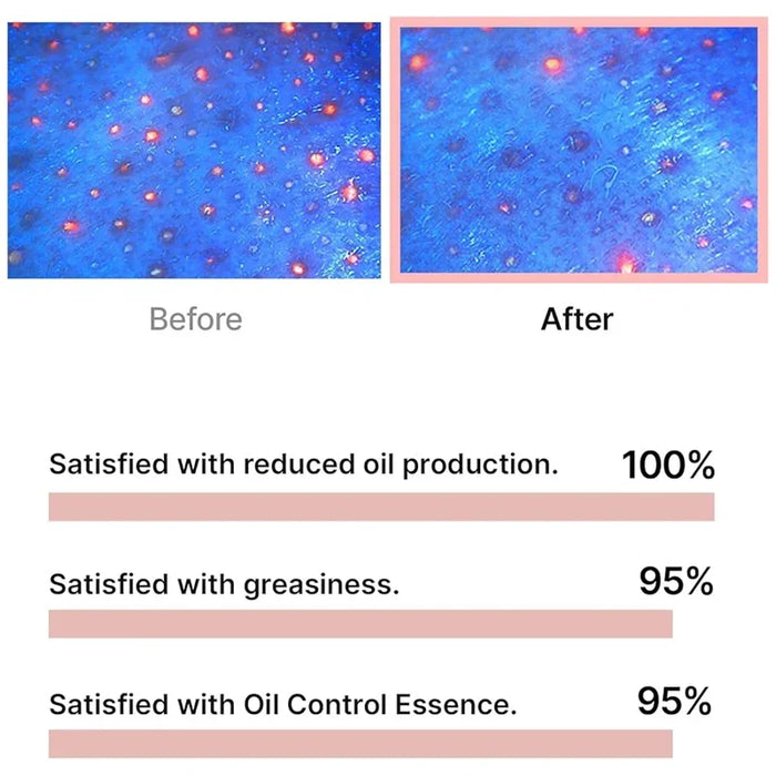 [celimax] Oil Control Capsule Essence 30ml - Ballagrio