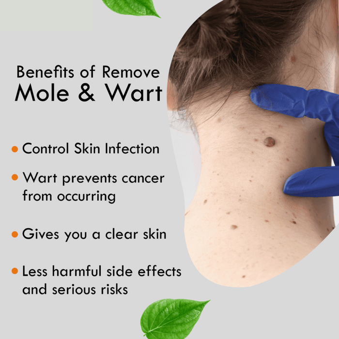 D-Fame Advanced Wart Removal Cream – Fast Results