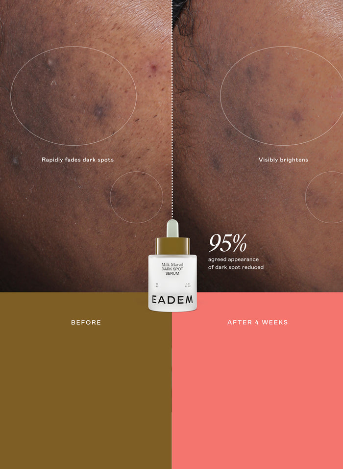 Dark Spot Expert