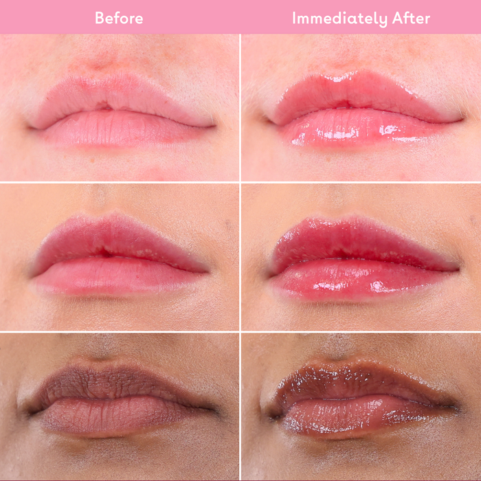 Before and after comparison of lips using the Q+A Hyaluronic Acid Lip Balm