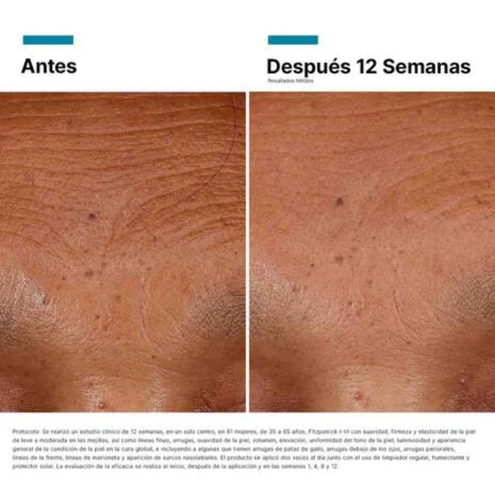 Hyaluronic Acid Intensifier