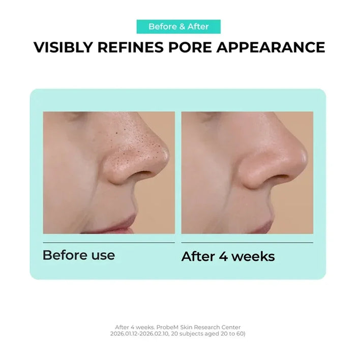 jumiso-overnight-zero-pore-nose-patch-10p-05