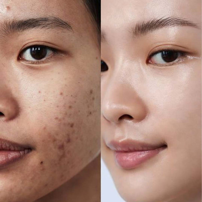 K-Glow Serum – Advanced Glass Skin Brightening Formula