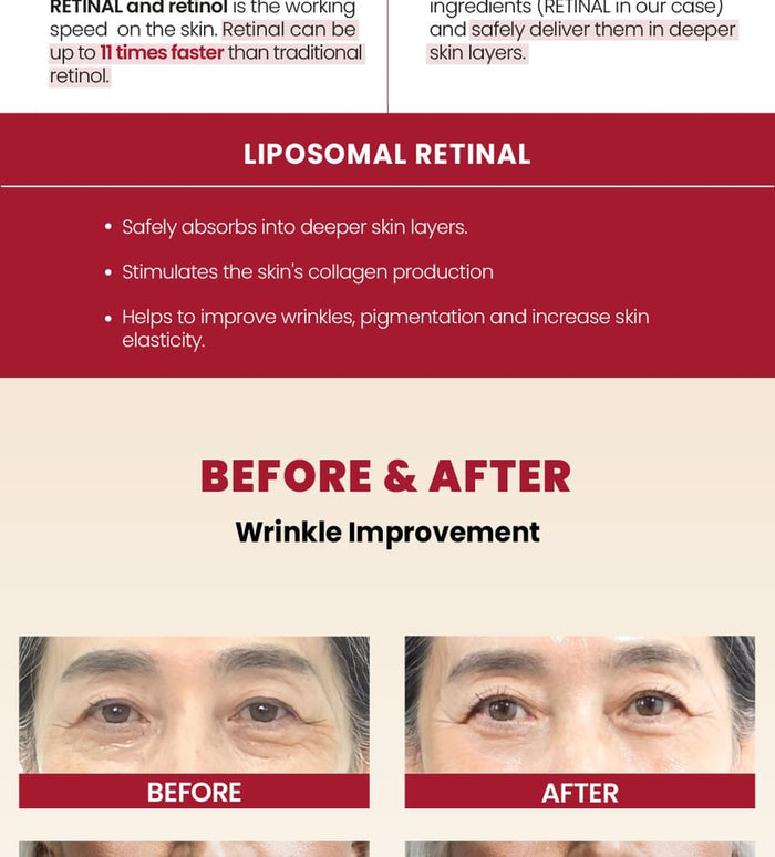 K-Secert Seoul1988 Cream Retinal Liposome 1% + Fermented Rice 50Ml