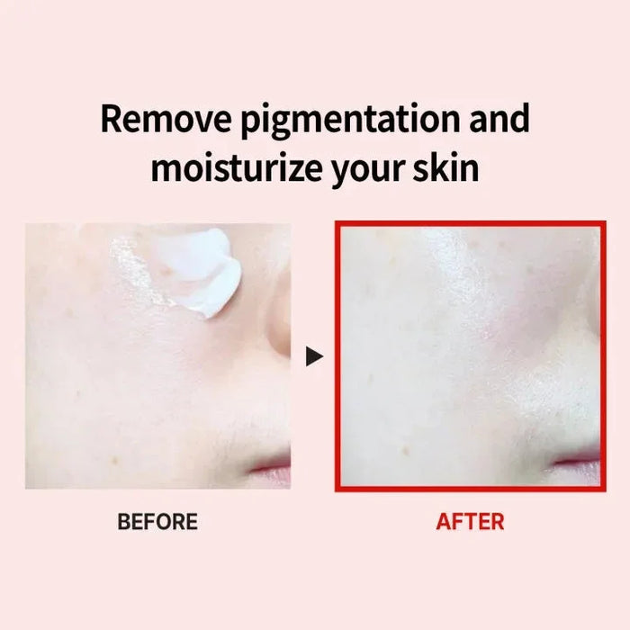 [MEDI-PEEL] Melanon X Drop Gel Cream 50g - Ballagrio
