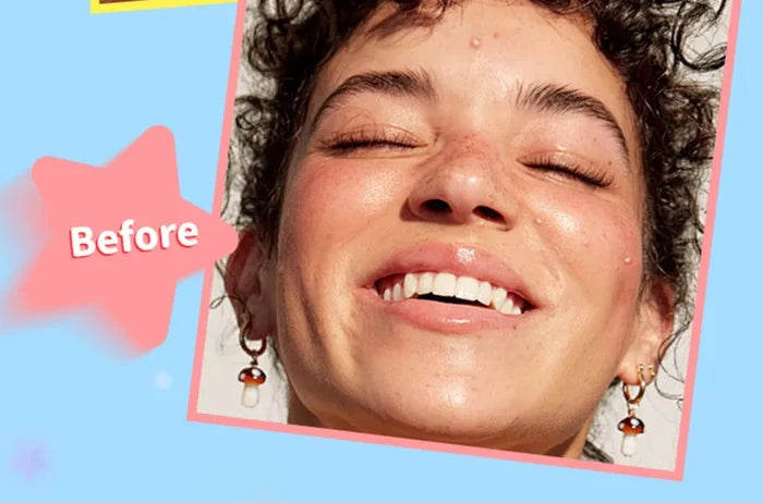 Mlsmile Smile Star Pimple Patches
