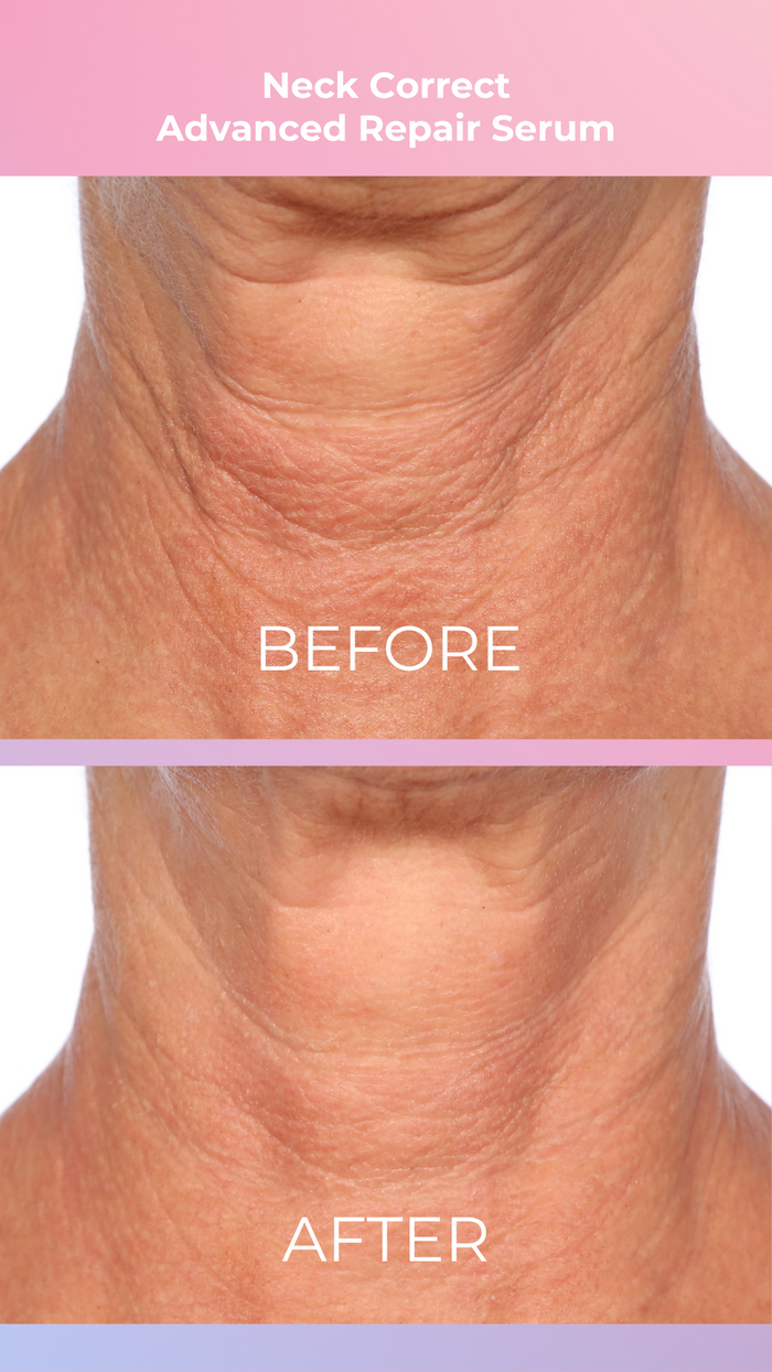 PRAI PRO Neck Correct Duo