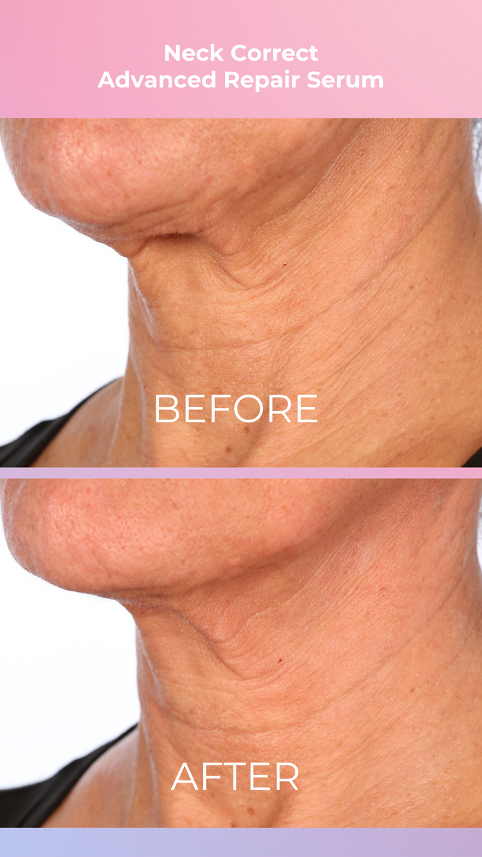 PRAI PRO Neck Correct Duo