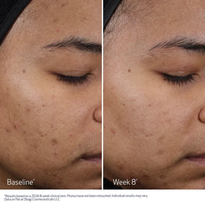 RESURFACING MULTI-ACID PEEL PADS