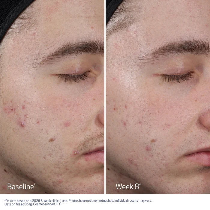 RESURFACING MULTI-ACID PEEL PADS
