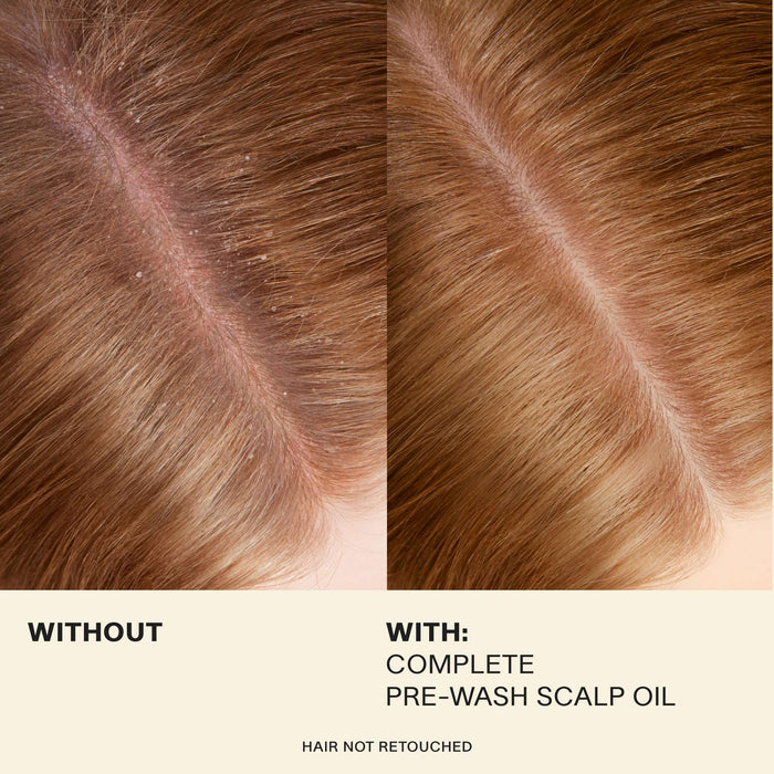 JVN Treatment Scalp Massage Moments (3-Pack) Scalp Massage Moments (3-Pack) sulfate-free silicone-free sustainable