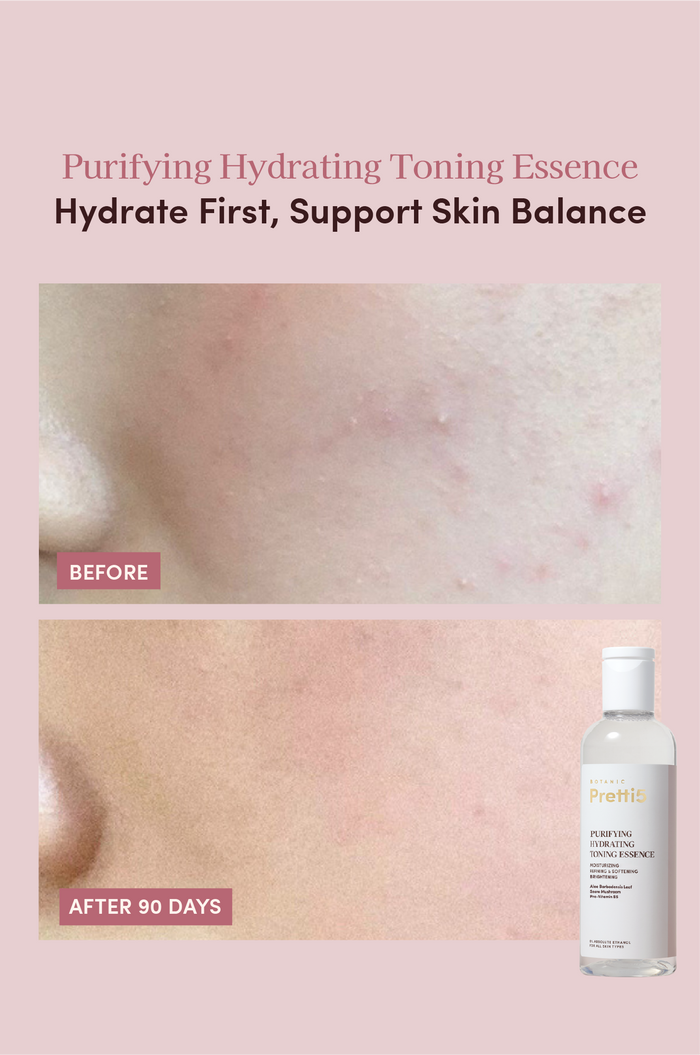 SENSITIVE SKIN INTENSIVE SOOTHING & REPAIR SET