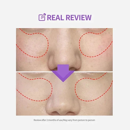[SUNGBOON EDITOR] Meoru Podo Vita C Turn-over Dark Spot Pad 140ml 60EA - Ballagrio