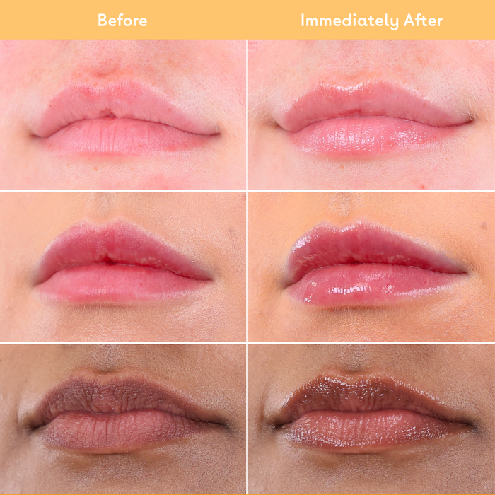 Before and after comparison of lips using the Q+A Super Food Lip Balm