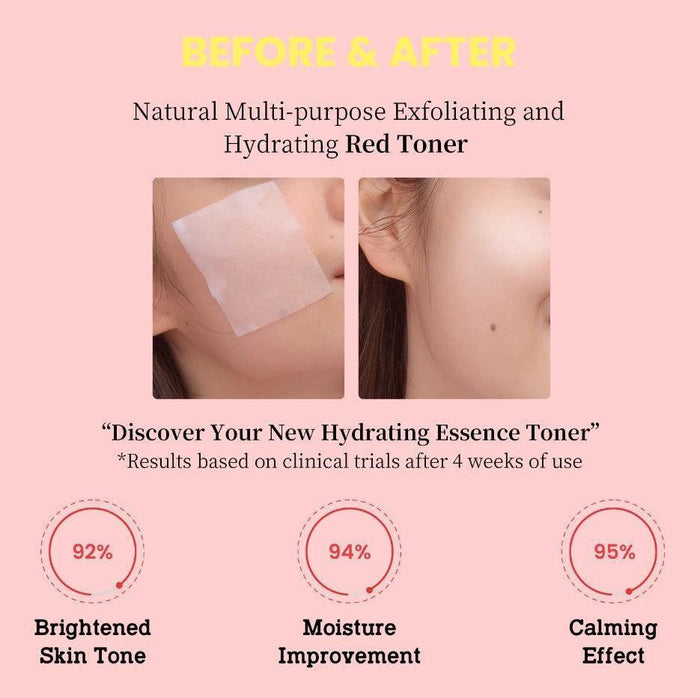 [Tovegan] Red Remedy Toner 150ml - Ballagrio