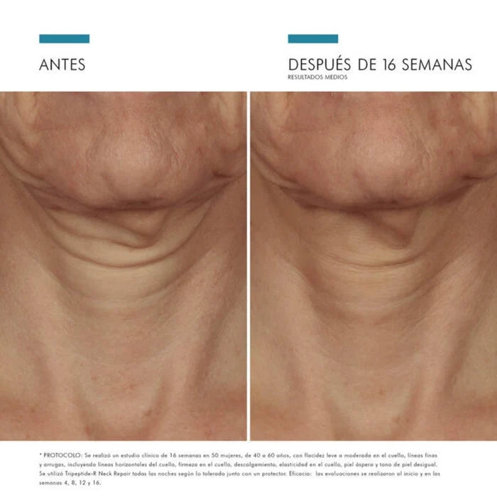 Tripeptide-R Neck Repair